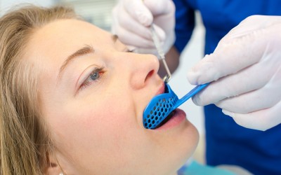 Taking Impressions by Dr. Megan Hatfield