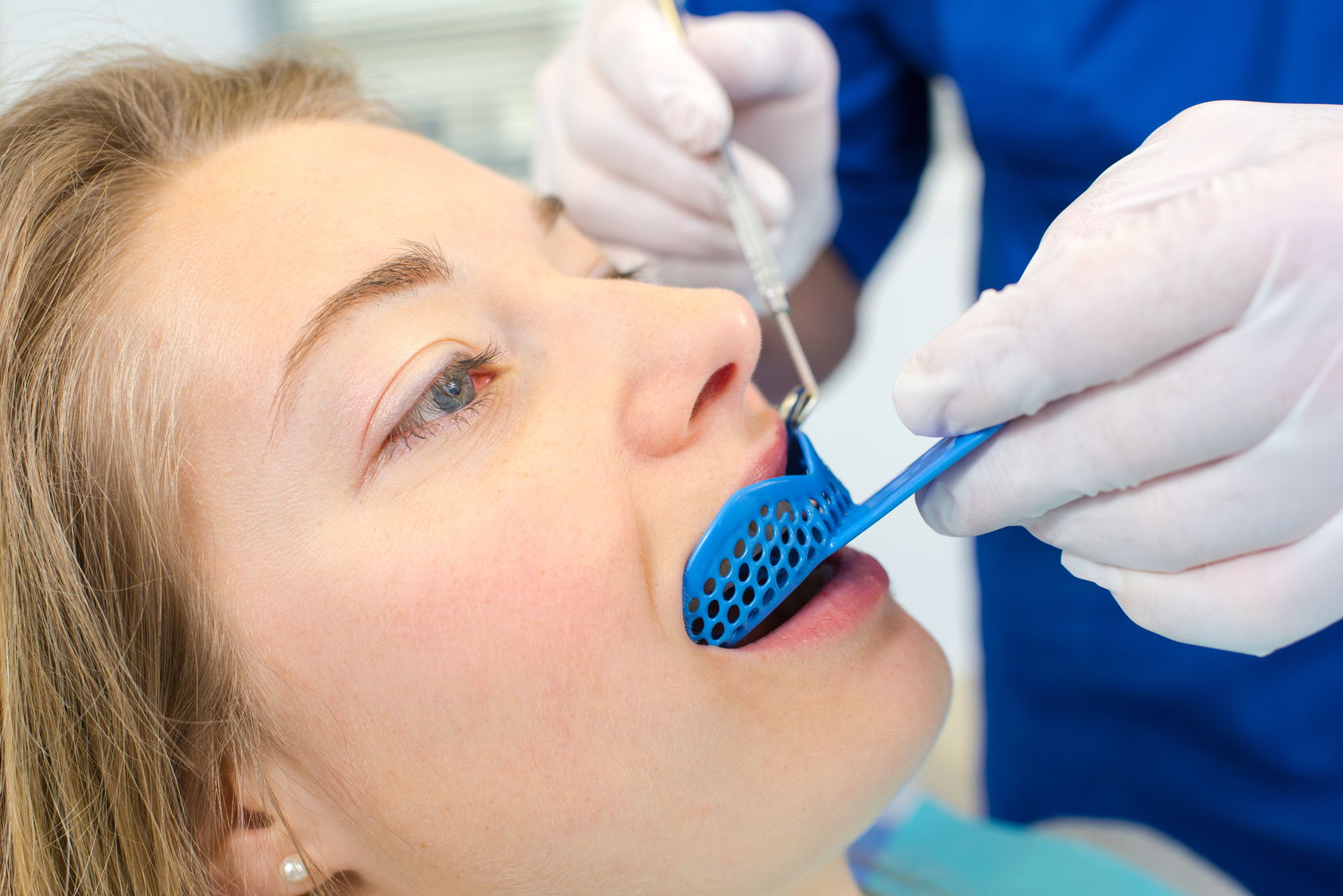 Taking Impressions by Dr. Megan Hatfield UK Adult Braces