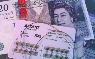 Are braces expensive?