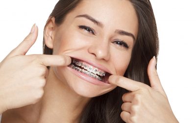 More UK adults are seeking orthodontic treatment