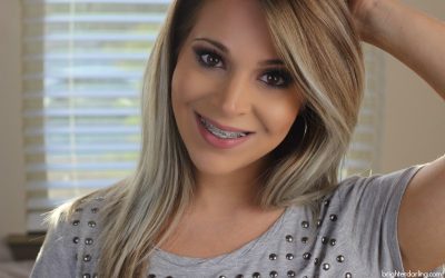 A braces blog update from Steffanie