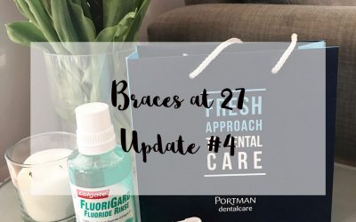 A braces update from Jade